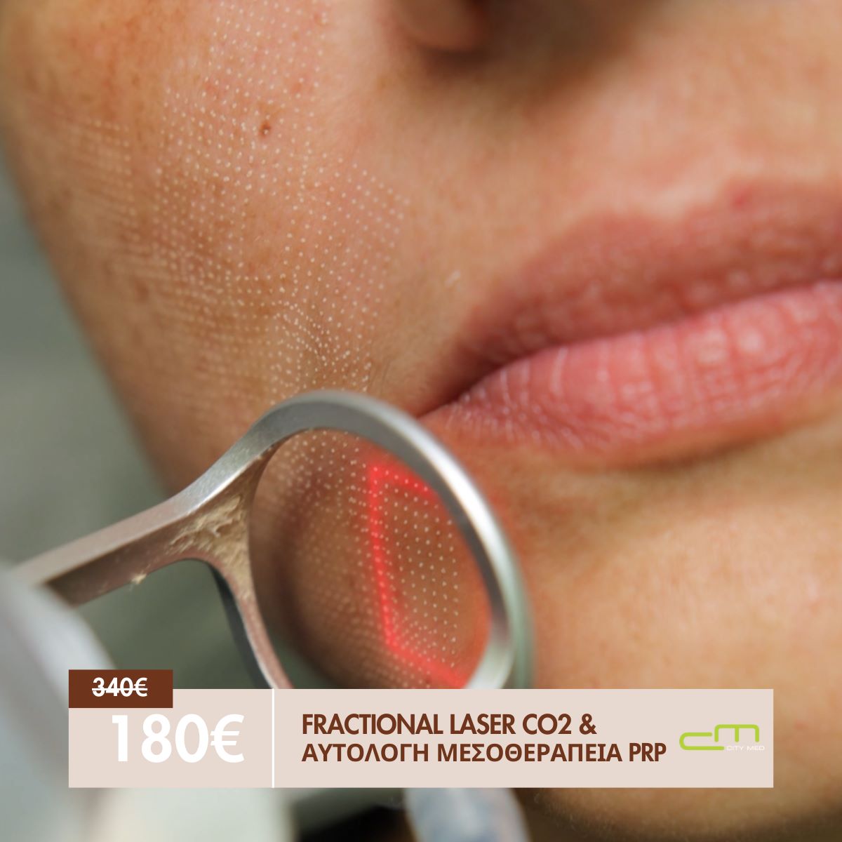 PRP Αυτόλογη Face & Fractional Face 180€ από 340€