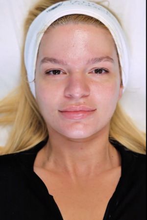 Glass Skin