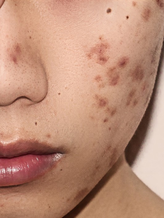 This image for Image Layouts addon