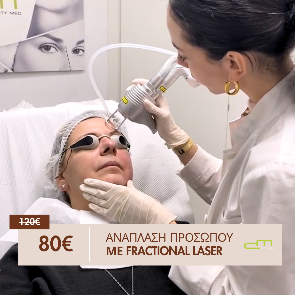 Fractional Laser - Ανάπλαση Προσώπου 80€