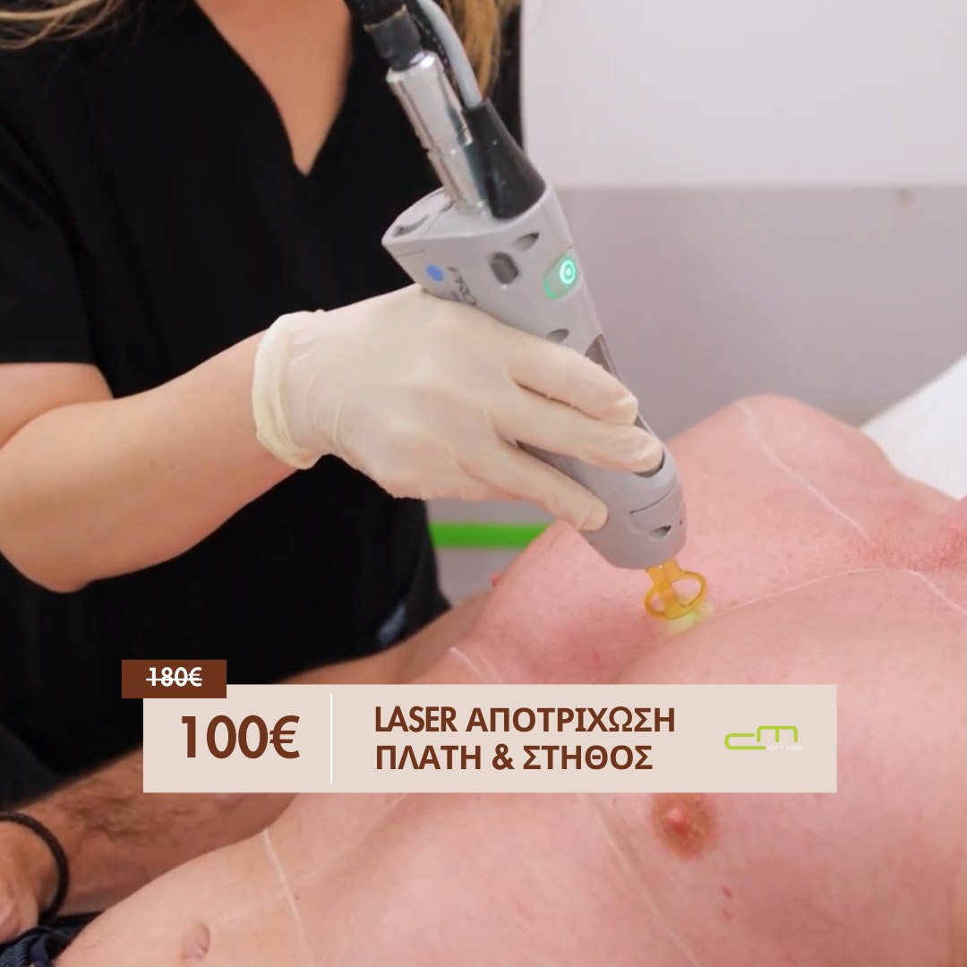 Laser Αποτρίχωση Πλάτη - Στήθος 100€